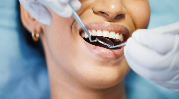 Best Emergency Broken Tooth Repair in Springfield, TN